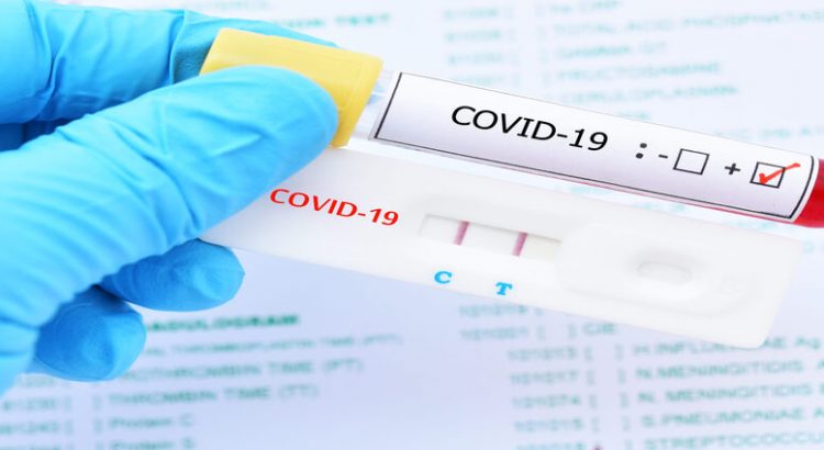 15 nuevos casos de Covid-19 en Sinaloa