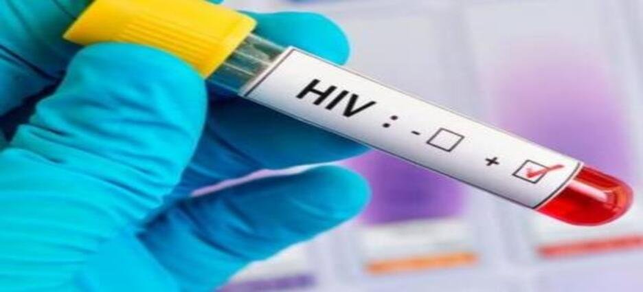 Al alza casos de sida en Sinaloa