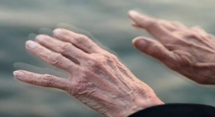 Sinaloa arriba de la media nacional por casos de Parkinson