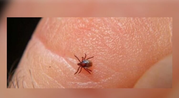 Seis muertes por rickettsia en Sinaloa